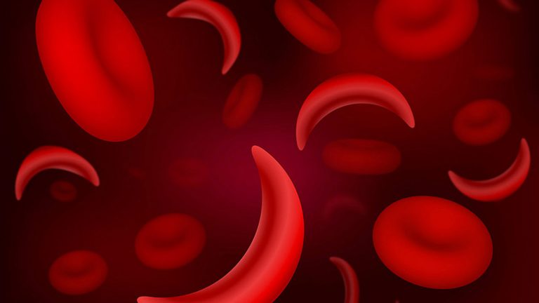 Vijana watakiwa kupima vinasaba wa selimundu (sickle cell)