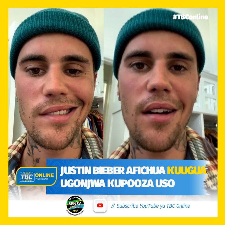 Justin Bieber afichua kuugua ugonjwa kupooza uso